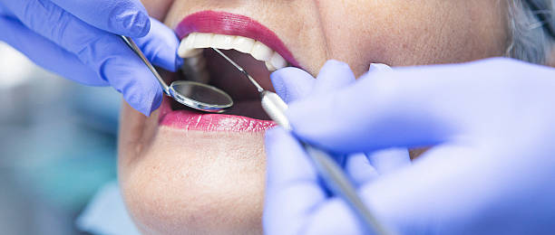 Best Emergency Tooth Extraction in Pacolet, SC